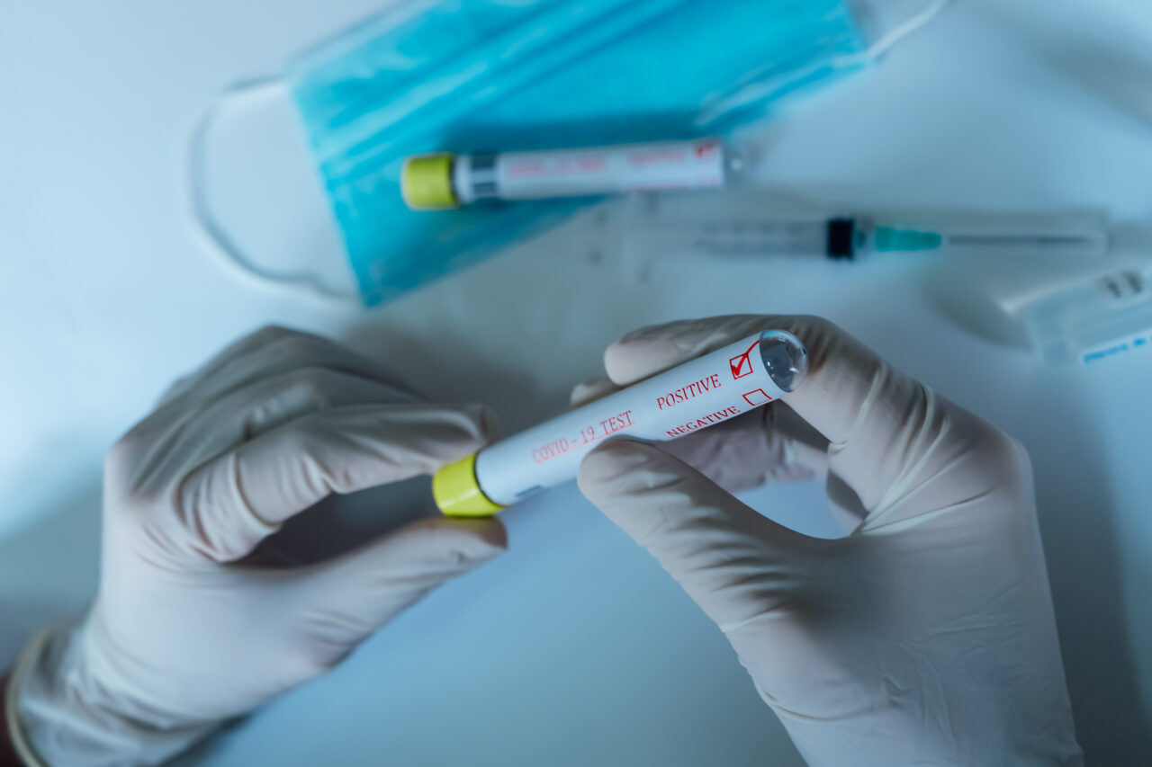 Hands,Of,A,Doctor,Showing,A,Positive,Coronavirus,Test,,In